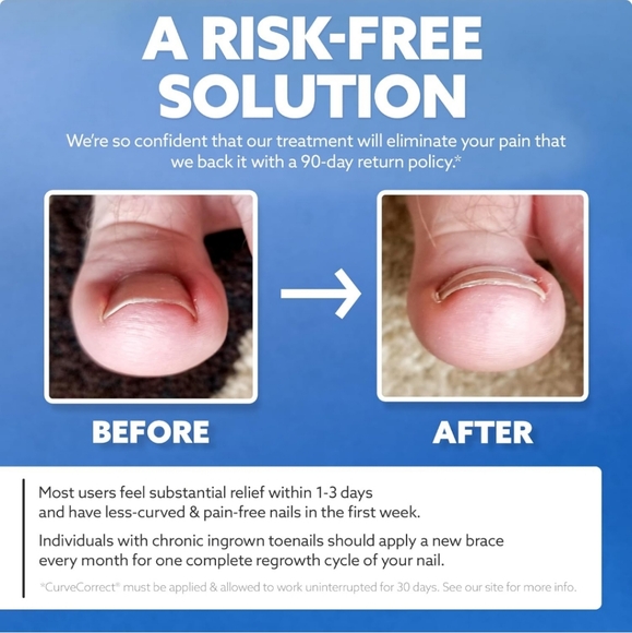 Curve Correct Ingrown Toenail Corrector Kit - Picture 5 of 9